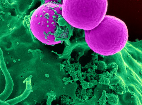 From Fossil Resources to Biomass: A Chemistry Perspective